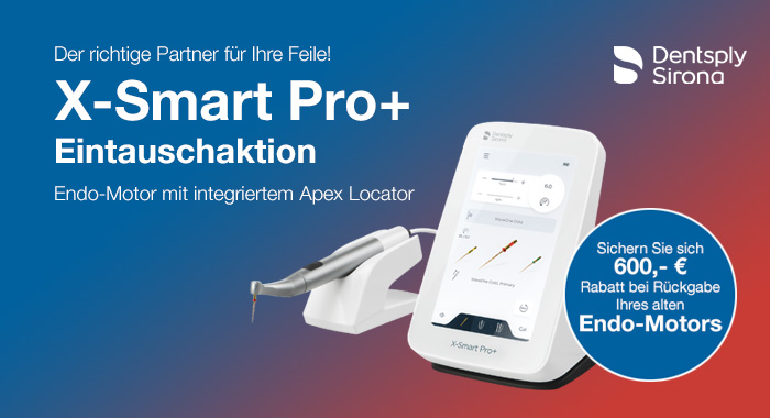 DS-X-Smart-Pro-Alt-gegen-Neu-700x380-2